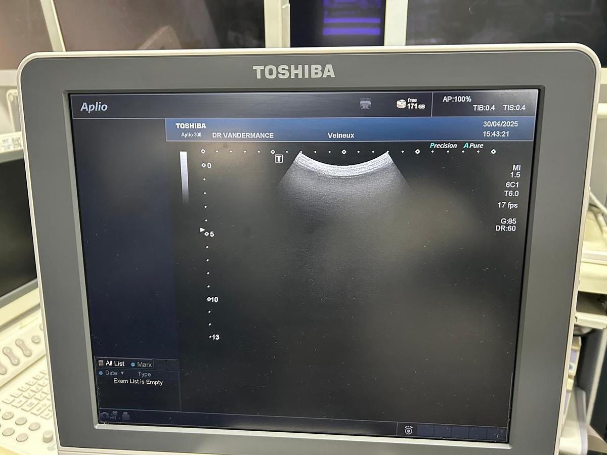 Used TOSHIBA Aplio 300 (TUS-A300)