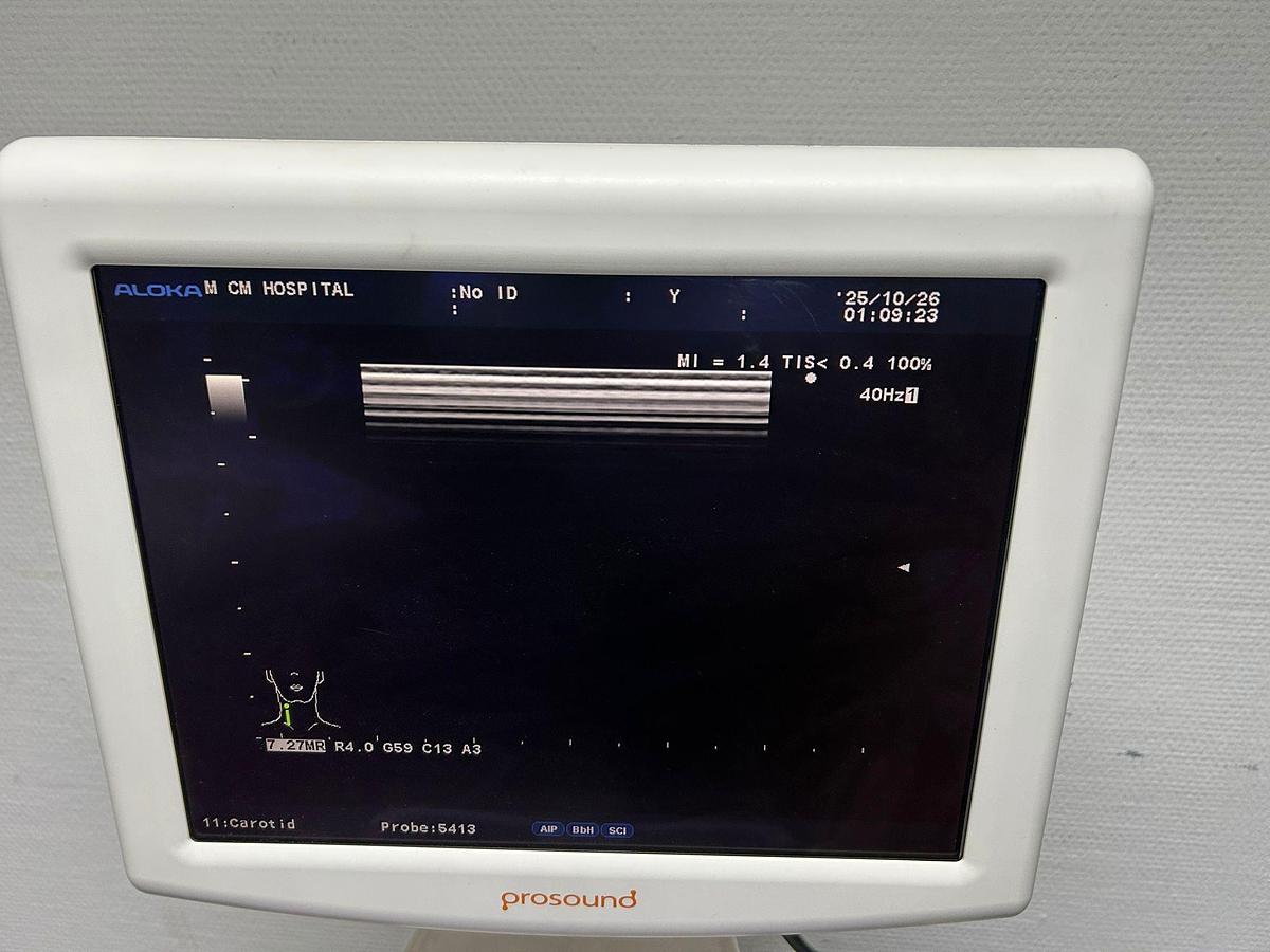 Used ALOKA ProSound 6