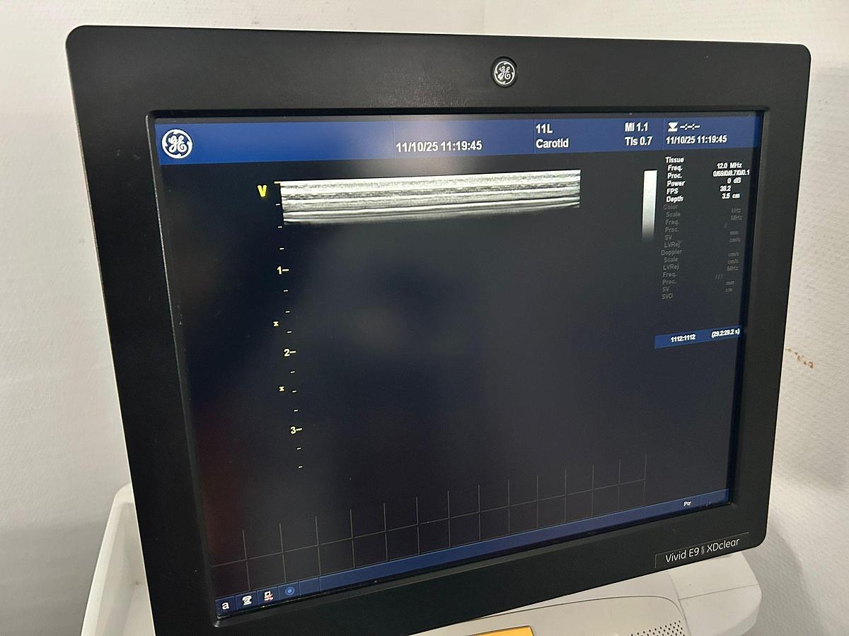 Used GE Vivid E9 XDclear