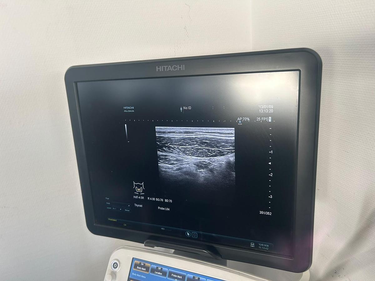Used Hitachi Aloka Arietta V70 | 4 Probes | Colour Doppler | Tested