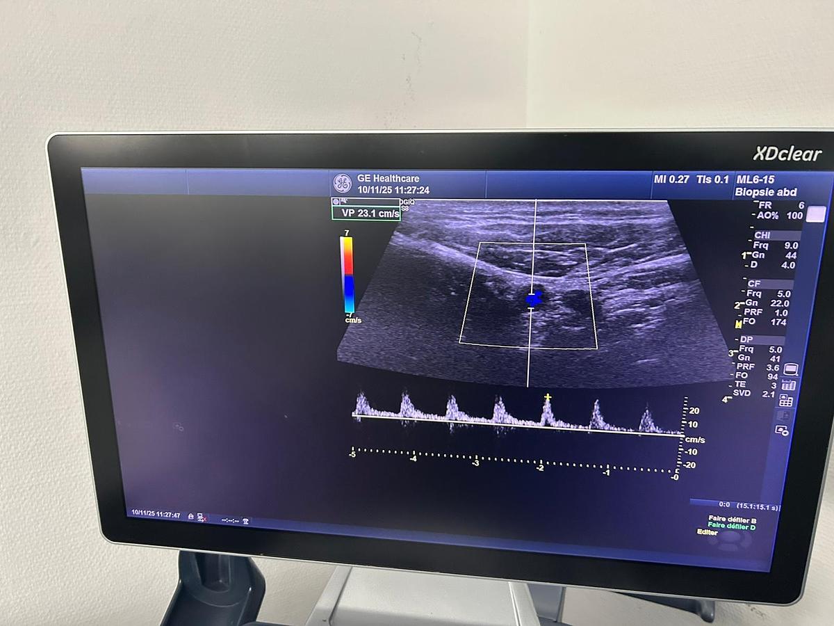 Used GE Logiq S8 XDclear