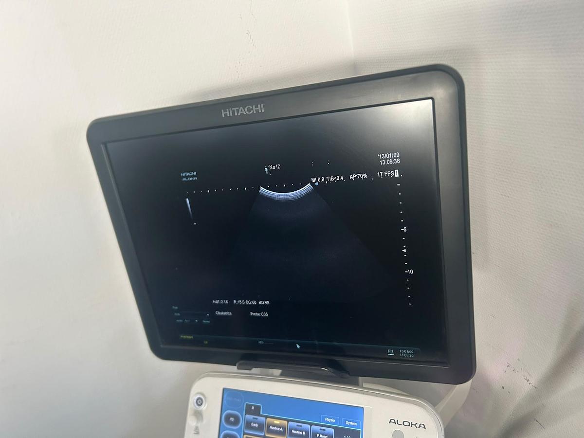 Used Hitachi Aloka Arietta V70 | 4 Probes | Colour Doppler | Tested