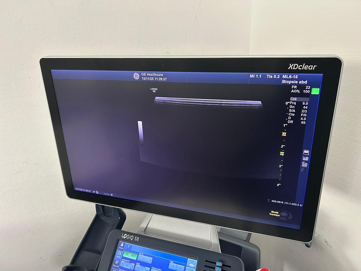 Used GE Logiq S8 XDclear