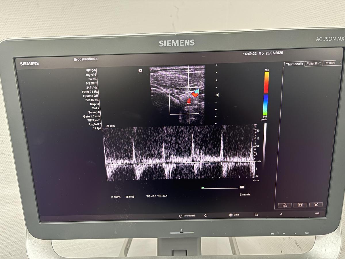 Used Siemens Acuson NX3 | 3 Probes & Printer | Tested |