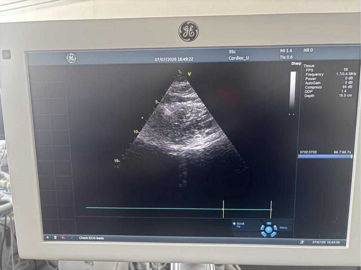 Used GE 3SC-RS Cardiac Ultrasound Probe | Excellent Condition | Tested | YOM: 2020