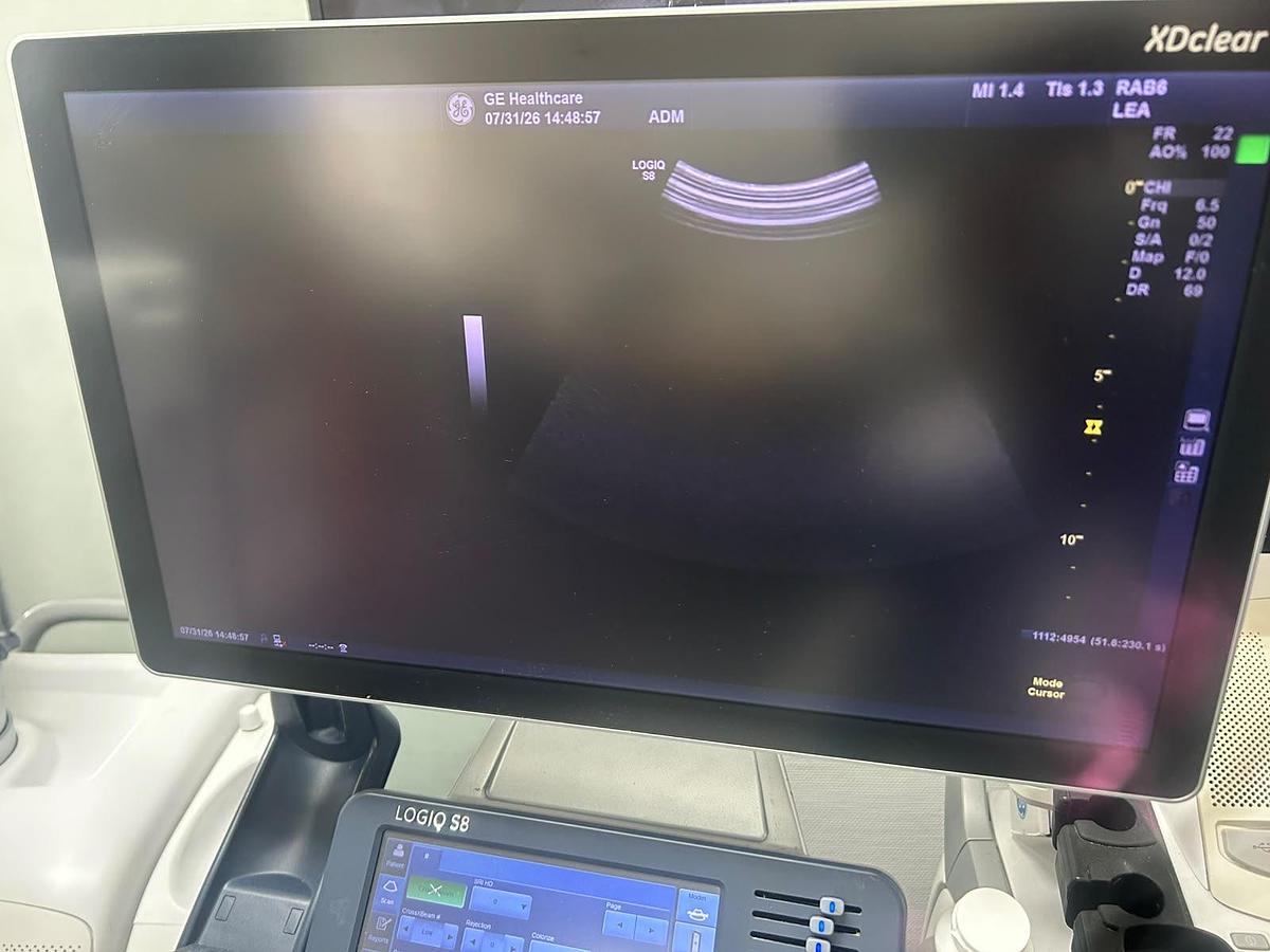 Used GE RAB6-D 4D Volume Ultrasound Probe | Excellent Image | Tested |