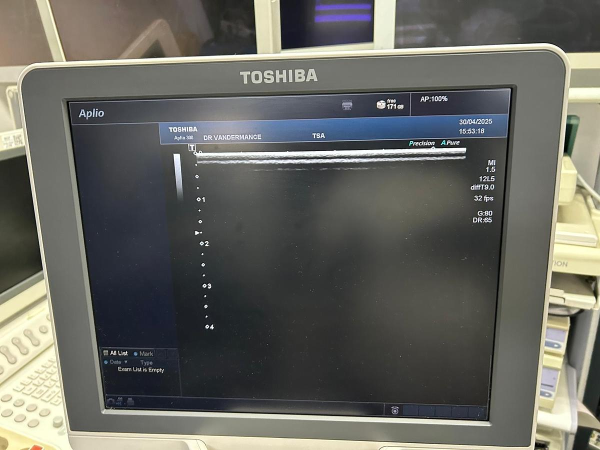 Used TOSHIBA Aplio 300 (TUS-A300)