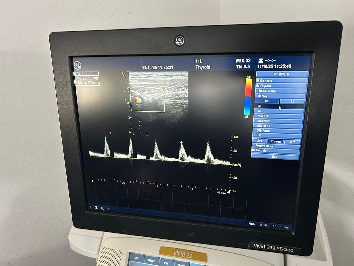 Used GE Vivid E9 XDclear