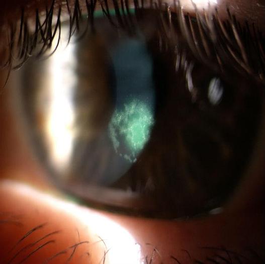 Used NEW S4Optiks Slit Lamp Camera Upgrade