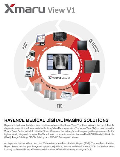 Rayence 1717SCV Tethered Flat Panel Detector (New)