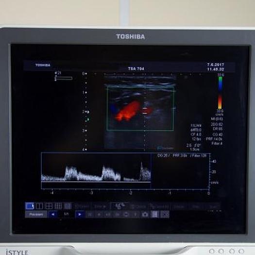 Used ECHOGRAPHE DOPPLER COULEUR TOSHIBA XARIO ISTYLE