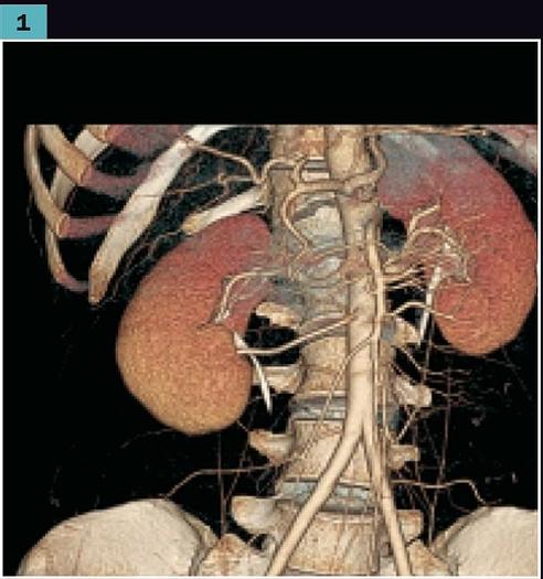 Reformado 2005 General Electric (GE) LightSpeed VCT
