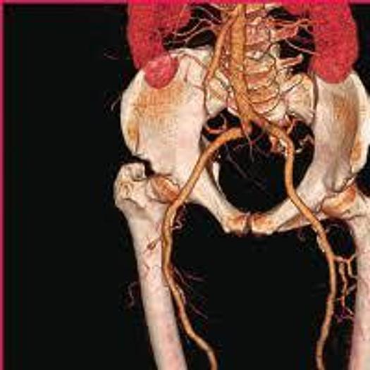 Refurbished 2004 General Electric (GE) LightSpeed