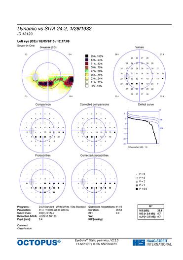 Refurbished Haag Streit Octopus 300 Visual Field Perimeter