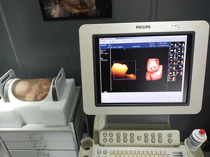 Gebraucht Philips HD 11xe 2197 Ultraschallgerät inkl. 3 Sonden und EKG Kabel