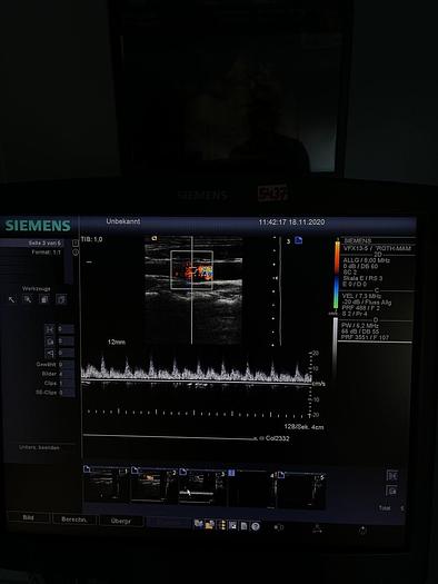 Gebraucht Siemens Acuson Antares Ultrschallsystem mit 3x Sonden, Mitsubishi P93D Drucker, DVD Recorder