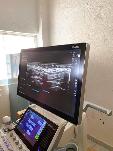 Usado 2018 ULTRASONIDO GE LOGIQ S7