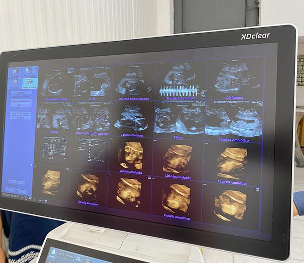 Usado 2018 ULTRASONIDO GE LOGIQ S7