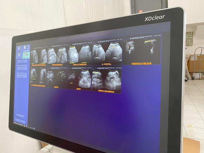 Usado 2018 ULTRASONIDO GE LOGIQ S7