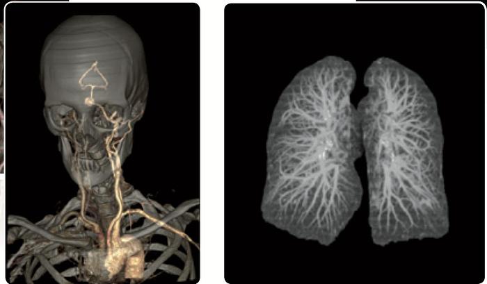 Refurbished 2003 General Electric (GE) LightSpeed