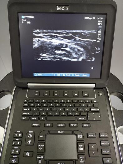 Gebraucht Sonosite Edge Ultraschallgerät inkl. 2 Sonden und Sony UP-D897 Drucker