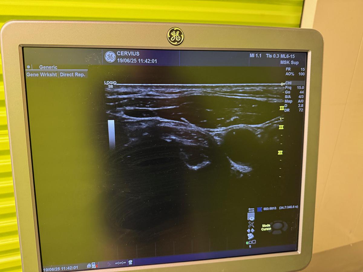 Used For Sale GE ML615D Ultrasound Transducer