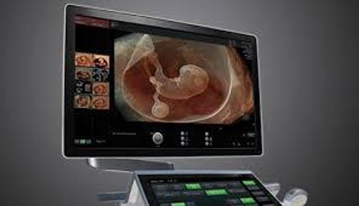 Used 2023 GE Voluson E10