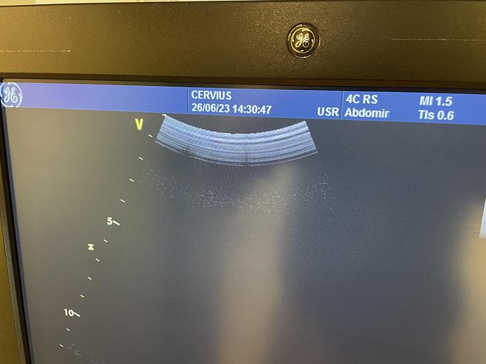 Used 2012 GE Vivid S5