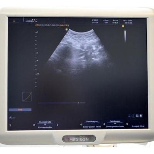 Gebraucht ECHOGRAPHE 3D 4D SAMSUNG MEDISON SONOACE X8 avec 3 sondes