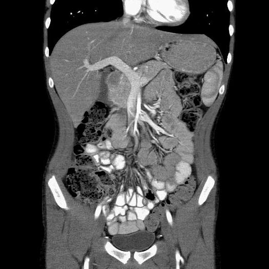 Reformado 2005 Toshiba Aquilion 64/120