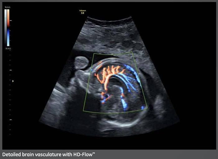 Used 2014 General Electric (GE) Voluson S8