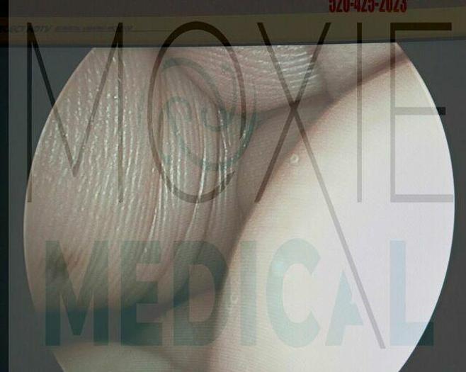 Used R WOLF PandView Plus Autoclave 25 Degree 4mm Hysteroscope 8654.402 by Richard Wolf