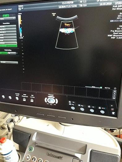 Used GE Logiq S8 OB / GYN - Vascular Ultrasound