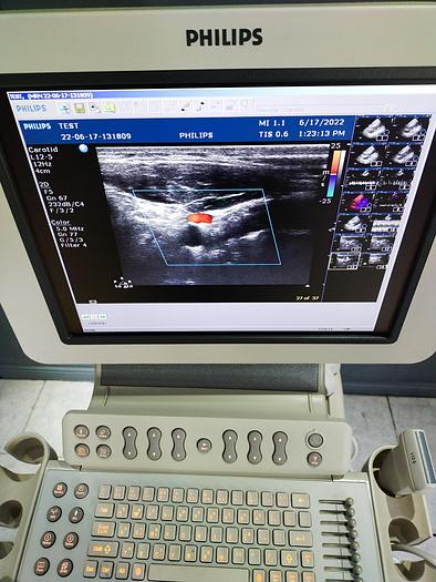 Gebraucht HD 11xe 2197 Ultraschallgerät mit 3 Sonden