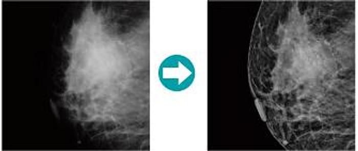 2020 FujiFilm FCR PRIMA Tm