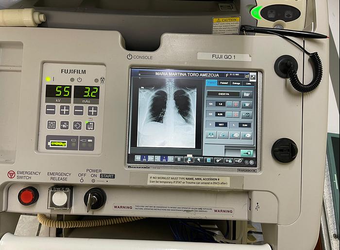 Used 2011 FujiFilm FCR GO-2