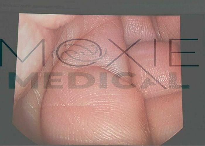 Used STRYKER HD Digital Camera System 1188-210-105, 1188-010-000