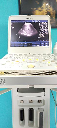 Gebraucht Philips CX50 tragbare Ultraschallgerät auf Philips CX Wagen inkl. Netzteil