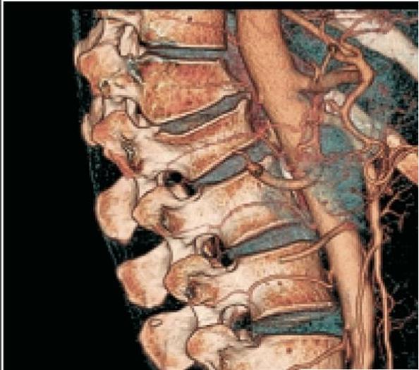 Refurbished 2010 General Electric (GE) LightSpeed VCT