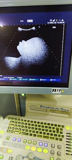 Gebraucht Hitachi 5-2 konvex Ultraschallsonde