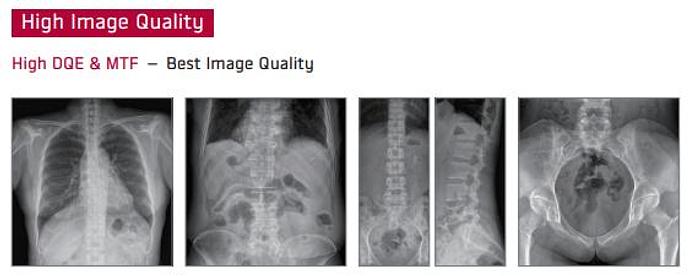 Vieworks VIVIX-S 1417N Wireless Flat Panel Detector