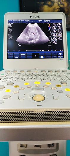 Gebraucht Philips CX50 tragbare Ultraschallgerät auf Philips CX Wagen inkl. Netzteil