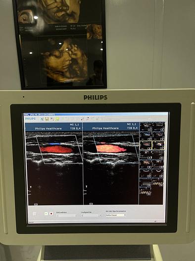 Gebraucht Philips HD 11 XE Ultraschallgerät mit 5x Sonden