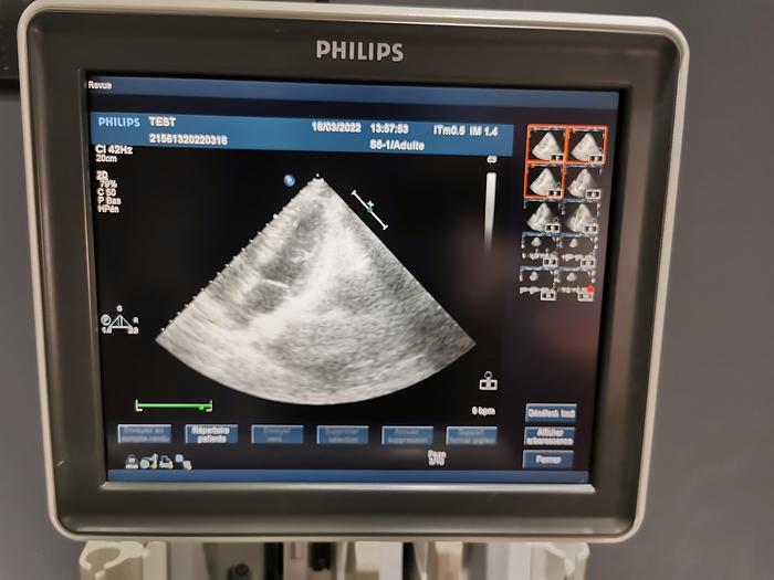 Gebraucht Philips,HX57