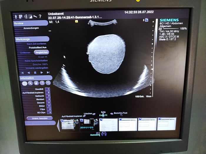 Gebraucht Siemens Acuson S2000 Ultraschallgerät mit Sonde, Drucker und DVD Brenner