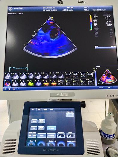 Gebraucht GE Vivid T8 Ultraschallsystem für Herz- und Gefäß-Ultraschall mit Kardio Sonde SW: R1.0.7