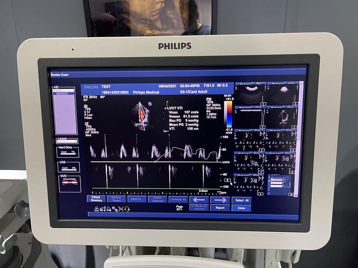 Gebraucht Philips iU22 Ultraschallgerät mit Flachmonitor, 5 Sonden, Sony Drucker, Fußschalter