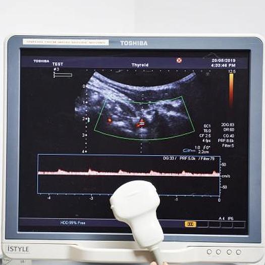 D'occasion ECHOGRAPHE ECRAN PLAT RADIO + CARDIO TOSHIBA XARIO XG