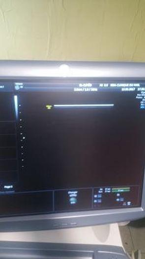 Refurbished GE Voluson E6 Shared Service Ultrasound