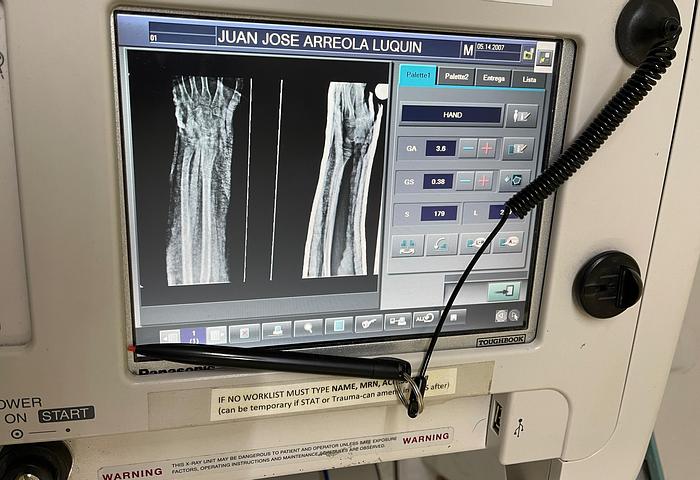 Used Fuji-GO 2 Portable X-ray